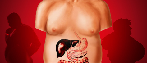 A obesidade e as suas complicações no sistema digestivo.