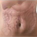 Esofagite eosinofílica: refluxo gastroesofágico ou alergia?